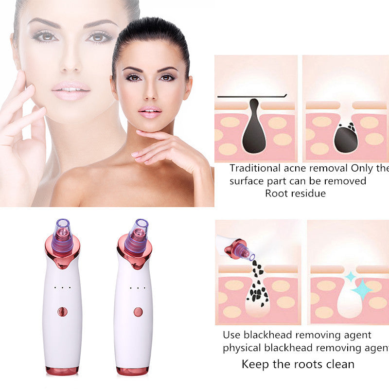 Blackhead Removal & Acne Vacuum